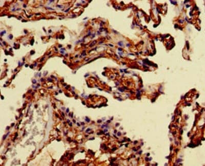 Anti-Mannosidase II/MAN2A1 antibody(ab224611)