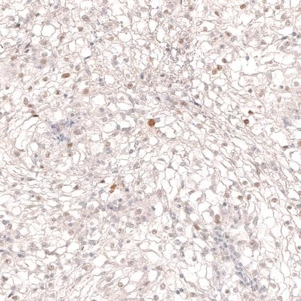 Anti-SOX6 antibody [CL5690](AB243576)