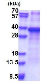 Recombinant Human RPS2 protein (denatured)(AB171474)