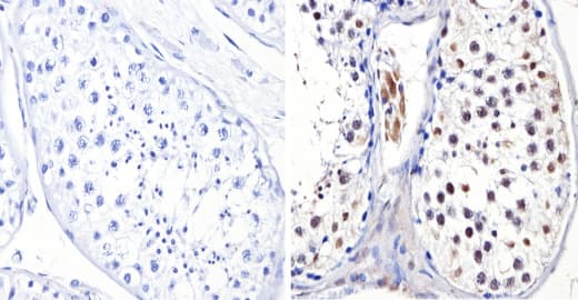 Anti-Dnmt3b antibody(AB2851)