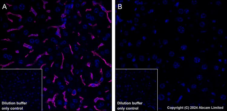 Alexa Fluor 647 Cd38 Antibody Epr21079 Ab320778  Immunohistochemistry Formalin Pfa Fixed Paraffin Embedded Sections Img437313