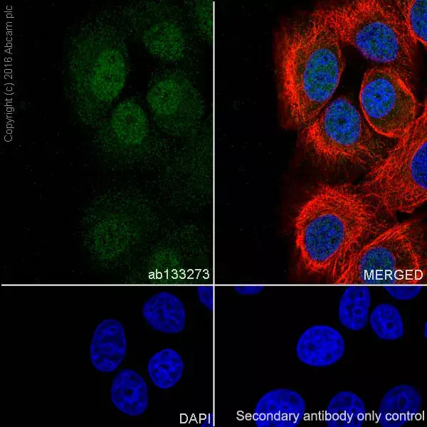 Anti-Androgen Receptor antibody [EPR1535(2)](AB133273)