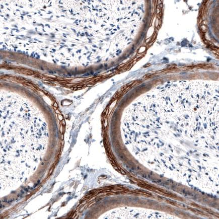 Anti-Laminin alpha 4/LAMA4 antibody [CL3185](AB242359)