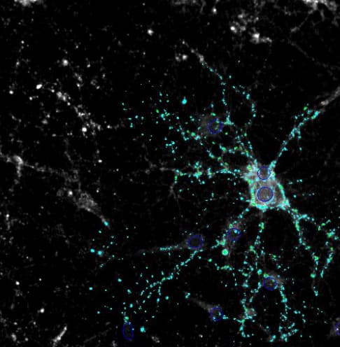 Synaptophysin Antibody Synaptic Marker Ab32594  Immunocytochemistry Immunofluorescence Img47279