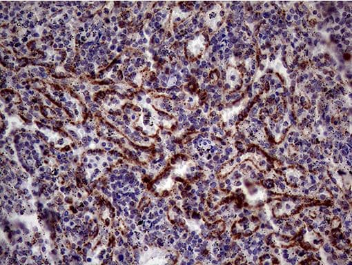 Cd161 Antibody Oti1d8 Bsa And Azide Free Ab273666  Immunohistochemistry Formalin Pfa Fixed Paraffin Embedded Sections Img107116