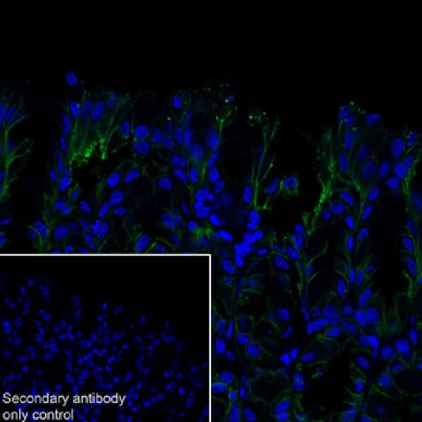 Anti-Claudin 18.2 antibody [EPR19202](AB222512)