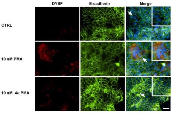 Anti-E Cadherin antibody [EP700Y] - Intercellular Junction Marker(AB40772)
