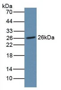 Anti-Noggin antibody [A11](AB239520)