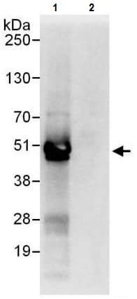Anti-YB1 antibody(AB225706)