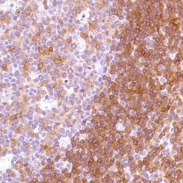 Anti-HLA-DPB1 antibody [SP229](AB227676)