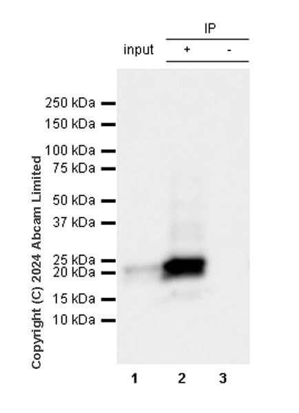 Anti-Prosurfactant Protein C antibody [RM1264](AB322443)