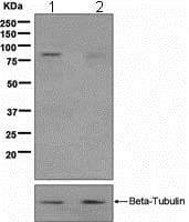 Hormone Sensitive Lipase Hsl Phospho S853 Antibody Epr23292 Bsa And Azide Free Ab247849  Western Blot Img148976