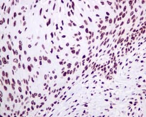 Mh2a1 Antibody Epr9358 Ab137117  Immunohistochemistry Formalin Pfa Fixed Paraffin Embedded Sections Img131669