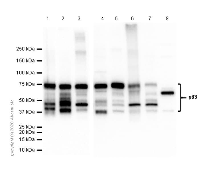 Anti-p63 antibody [EPR5701](AB124762)