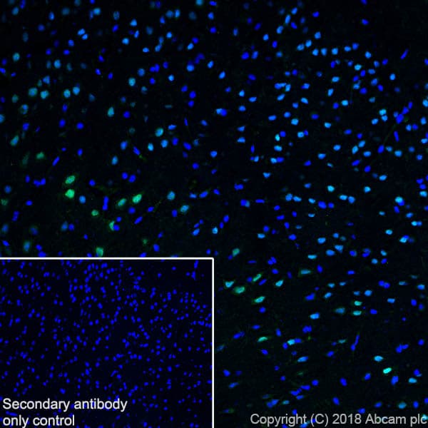 Anti-SATB2 antibody [SP281] - C-terminal(AB227686)