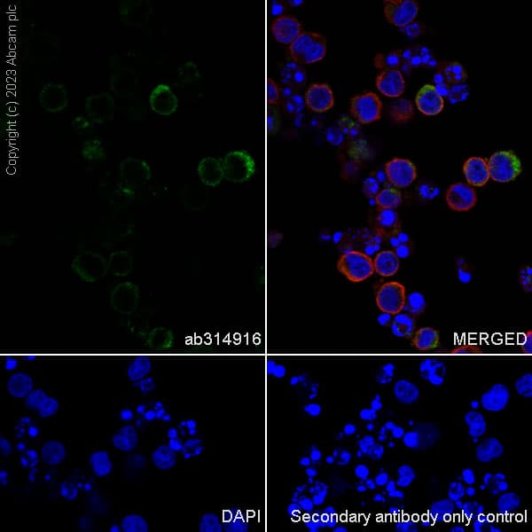 Anti-Neutrophil Elastase antibody [RM1077](AB314916)
