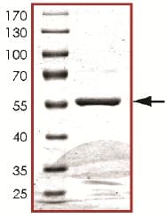 Recombinant Human Cdk4 protein(AB126909)