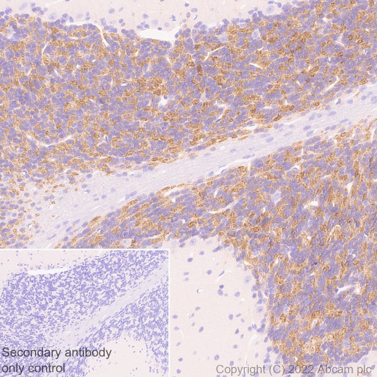 Anti-GABRD antibody [EPR25324-253](AB300348)