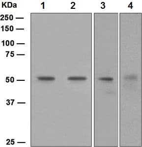 Anti-FLI1 antibody [EPR4646](AB133485)