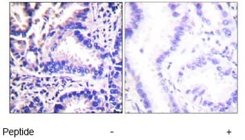 Anti-gamma Synuclein/SNCG antibody(AB55424)