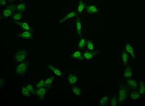E2f4 Antibody 24e12 Ab314180  Immunocytochemistry Immunofluorescence Img419576