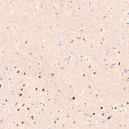 Anti-FOXP2 antibody [CL5312](AB243038)