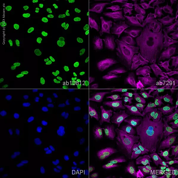 Anti-Histone H3 (acetyl K9) antibody - ChIP Grade(AB10812)