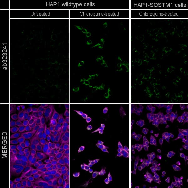 Alexa Fluor 594 Alpha Tubulin Antibody Ep1332y Microtubule Marker Ab202272  Immunocytochemistry Immunofluorescence Img440841