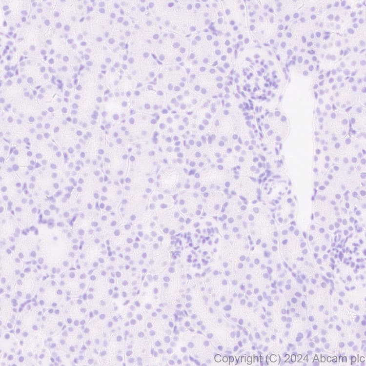 Anti-EBV Nuclear Antigen/EBNA1 antibody [EPR28706-78] - BSA and Azide free(AB316861)