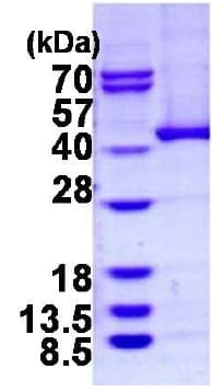 Ab124573  Sds Page Img7272