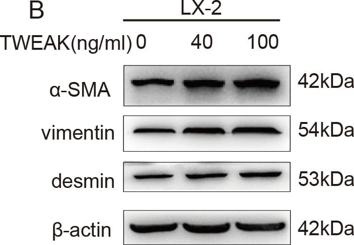 Anti-Desmin antibody [Y66] - Cytoskeleton Marker(AB32362)
