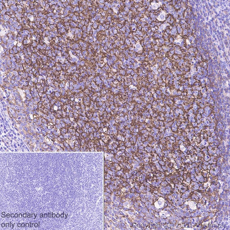 Cd21 Antibody Ep3093 Bsa And Azide Free Ab271855  Immunohistochemistry Formalin Pfa Fixed Paraffin Embedded Sections Img166711
