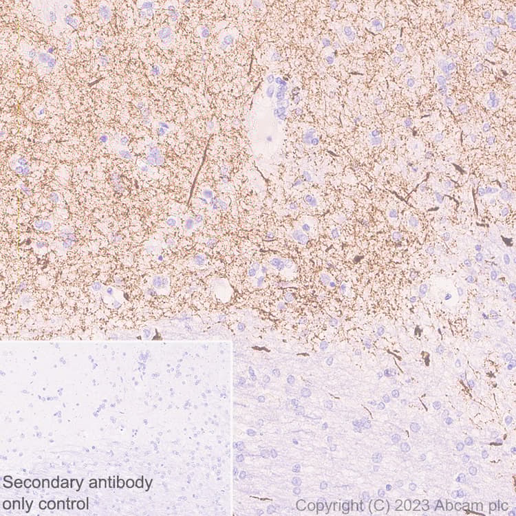 Anti-Tyrosine Hydroxylase antibody [RM1085](AB315252)