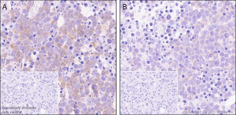 Anti-EIF2S1 (phospho S51) antibody [E90](AB32157)