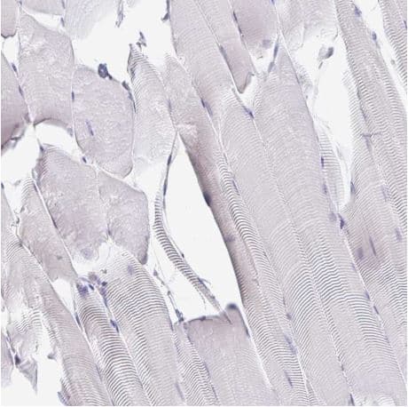 Derlin 2 Antibody Ab185087  Immunohistochemistry Formalin Pfa Fixed Paraffin Embedded Sections Img120167