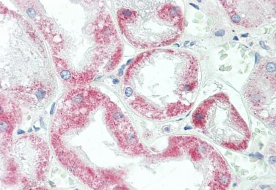 Anti-YTHDF1 antibody(AB230330)