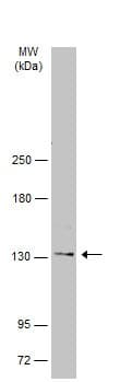 Anti-Desmoglein 2/DSG2 antibody(AB96761)