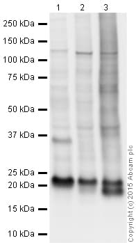 Anti-TAGLN/Transgelin antibody(AB14106)