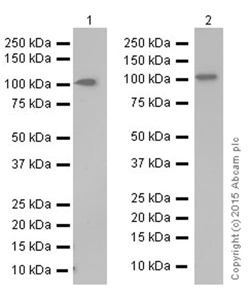 Anti-Sarcomeric Alpha Actinin antibody [EP2529Y](AB68167)