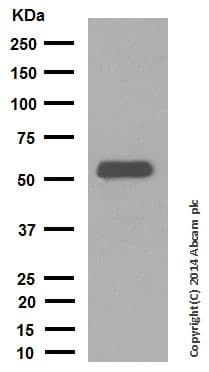 Anti-Cytokeratin 10 antibody [EP1607IHCY] - Cytoskeleton Marker(AB76318)