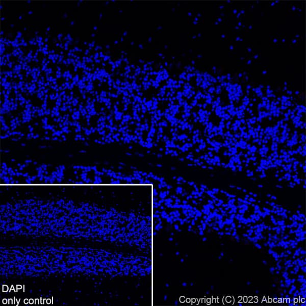 Alexa Fluor® 647 Anti-TBR1 antibody [EPR8138(2)](AB314473)