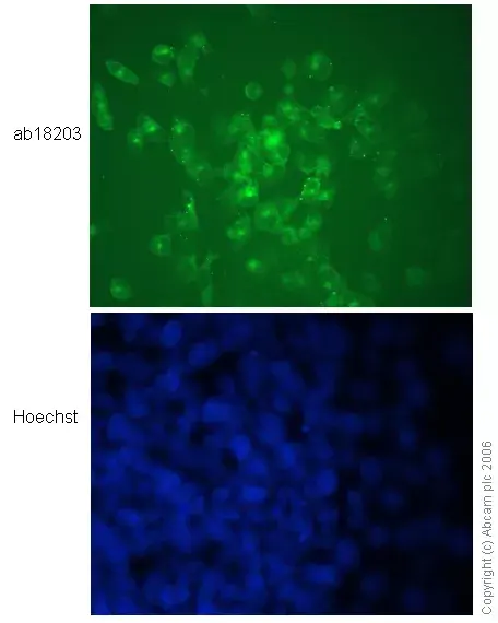 Anti-N Cadherin antibody - Intercellular Junction Marker(AB18203)