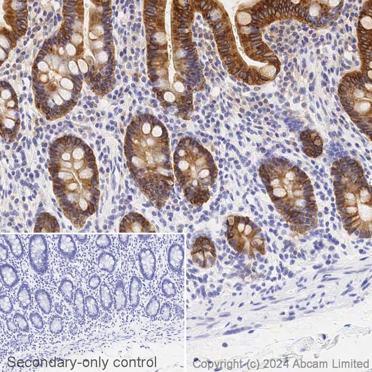Avidin/Biotin Blocking Kit(ab64212)