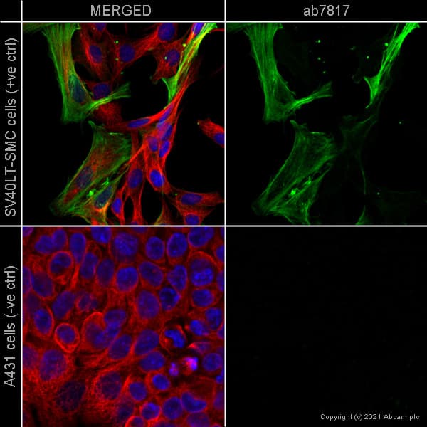 Anti-alpha smooth muscle Actin antibody [1A4] - BSA and Azide free(AB240654)