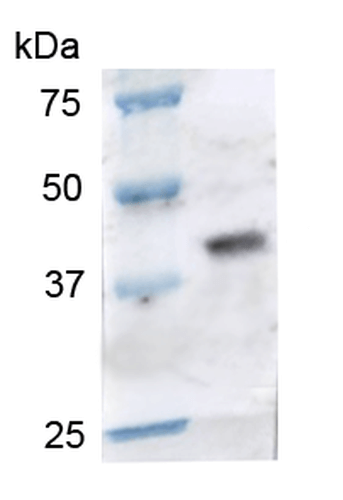 Ccr2 Antibody Ab223366  Western Blot Img81196