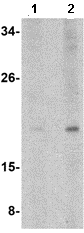 Kctd15 Antibody Ab106373  Western Blot Img110779