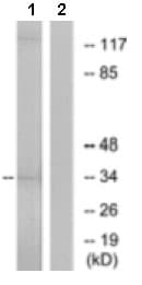 Or10ad1 Antibody Ab129895  Western Blot Img152362