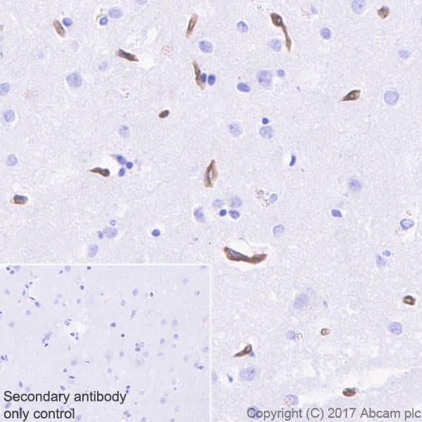 Anti-BCRP/ABCG2 antibody [EPR21122](AB229193)