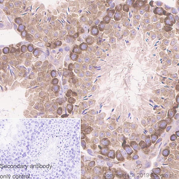 Ythdc2 Antibody Epr21820 49 Bsa And Azide Free Ab259277  Immunohistochemistry Formalin Pfa Fixed Paraffin Embedded Sections Img120243