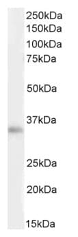Anti-VDAC2 antibody(AB37985)